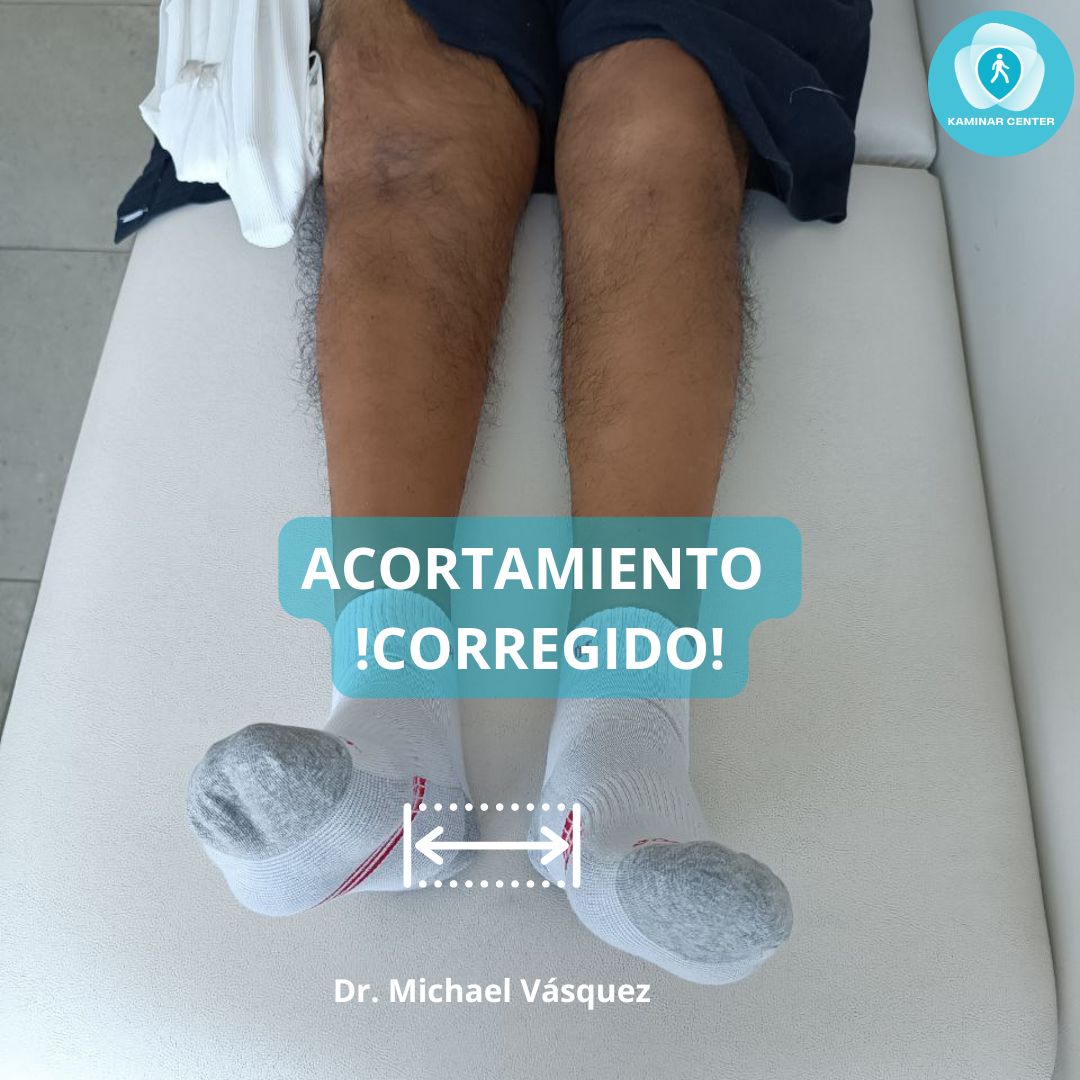 CORRECCION DE DEFORMI